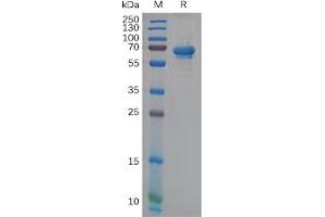 Human NCR1 Protein, hFc Tag on SDS-PAGE under reducing condition.
