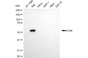 Western blotting analysis using FGR antibody (ABIN7798693).