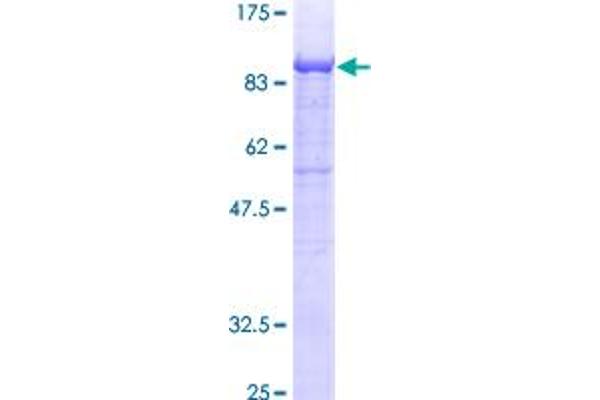 GALC Protein (AA 27-669) (GST tag)