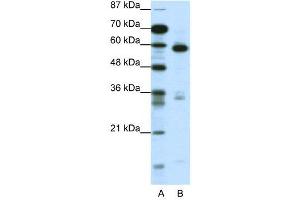 WB Suggested Anti-MBD1  Antibody Titration: 1. (MBD1 antibody  (C-Term))