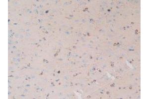 Figure. (MAP4 antibody  (AA 2-250))