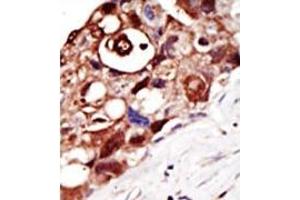 Image no. 1 for anti-GPI-anchor transamidase (GPI8) (N-Term) antibody (ABIN357725) (PIGK antibody  (N-Term))