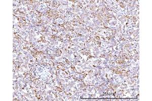 IHC analysis of RPN1 using anti-RPN1 antibody (ABIN7600447). (RPN1 antibody  (AA 196-495))