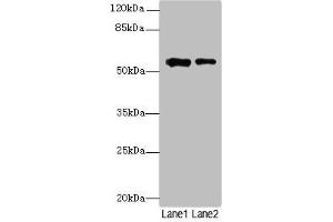 Western blot All lanes: WDR34 antibody at 1. (WDR34 antibody  (AA 1-210))