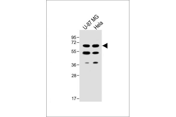UGT8 anticorps  (AA 366-393)