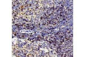 Immunohistochemistry (Paraffin-embedded Sections) (IHC (p)) image for anti-Interleukin 2 Receptor, alpha (IL2RA) antibody (ABIN7074349)