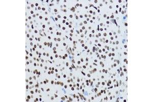 Immunohistochemistry of paraffin-embedded rat ovary using Acetyl-Histone H3-K9 antibody (ABIN7267675) at dilution of 1:200 (40x lens). (Histone 3 antibody  (H3K9))