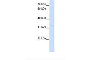 Image no. 1 for anti-Voltage-Dependent Anion Channel 2 (VDAC2) (AA 38-87) antibody (ABIN6737761) (VDAC2 antibody  (AA 38-87))