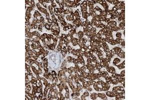 Immunohistochemical staining of human liver with MITD1 polyclonal antibody  shows strong cytoplasmic positivity in hepatocytes at 1:20-1:50 dilution.