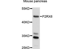 Western blot analysis of extracts of mouse pancreas, using P2RX6 antibody (ABIN6003829) at 1/1000 dilution. (P2RX6 antibody)