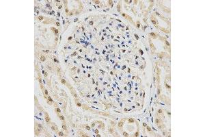 Immunohistochemistry (IHC) image for anti-Small Nuclear Ribonucleoprotein Polypeptide E (SNRPE) antibody (ABIN1876676) (SNRPE antibody)