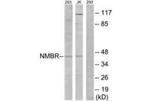 Western blot analysis of extracts from 293/Jurkat cells, using NMBR Antibody. (NMBR antibody  (AA 221-270))