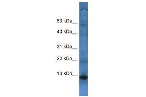 Western Blot showing TMEM141 antibody used at a concentration of 1 ug/ml against Fetal Liver Lysate (TMEM141 antibody  (C-Term))