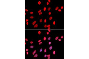 Immunofluorescence (IF) image for anti-Hepatoma-Derived Growth Factor (HDGF) antibody (ABIN1876535) (HDGF antibody)