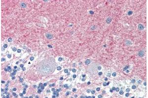 Human Brain, Cerebellum (formalin-fixed, paraffin-embedded) stained with THY1 antibody ABIN396935 at 10 ug/ml followed by biotinylated anti-mouse IgG secondary antibody ABIN481714, alkaline phosphatase-streptavidin and chromogen. (CD90 antibody)