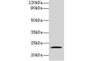 Western blot All lanes: JAM2 antibody at 2 μg/mL + Recombinant Junctional adhesion molecule B protein Secondary Goat polyclonal to rabbit IgG at 1/10000 dilution Predicted band size: 34, 30, 35 kDa Observed band size: 23 kDa (JAM2 antibody  (AA 29-238))