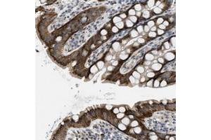 Immunohistochemical staining of human rectum with ZFPL1 polyclonal antibody  shows cytoplasmic positivity with a granular pattern in glandular cells.