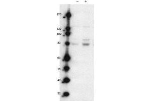 Western Blot of Rabbit anti-MARK2pT595 antibody.