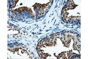 Immunohistochemical staining of paraffin-embedded Kidney tissue using anti-SATB1mouse monoclonal antibody. (SATB1 antibody)