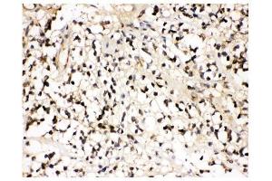 IHC analysis of VCP using anti-VCP antibody (ABIN3043958). (VCP antibody  (C-Term))
