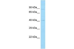 Host: Rabbit Target Name: QSOX2 Sample Type: OVCAR-3 Whole Cell lysates Antibody Dilution: 1. (QSOX2 antibody  (Middle Region))