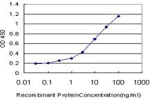 Detection limit for recombinant GST tagged IRAK3 is approximately 0. (IRAK3 antibody  (AA 497-596))
