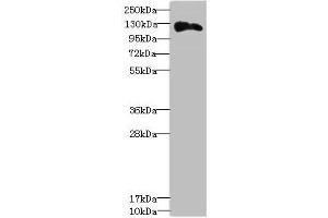 Western blot All lanes: ANLNantibody at 3. (Anillin antibody  (AA 845-1124))