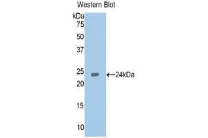 Western Blotting (WB) image for anti-Insulin-Like Growth Factor Binding Protein 6 (IGFBP6) (AA 31-240) antibody (ABIN1859312) (IGFBP6 antibody  (AA 31-240))