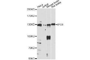Western blot analysis of extracts of various cell lines, using IPO8 antibody. (Importin 8 antibody)