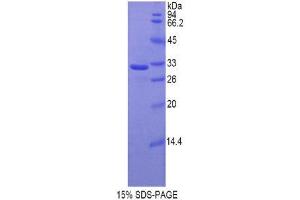 SDS-PAGE (SDS) image for Hyaluronan Synthase 1 (HAS1) (AA 164-421) protein (His tag) (ABIN2121267) (HAS1 Protein (AA 164-421) (His tag))