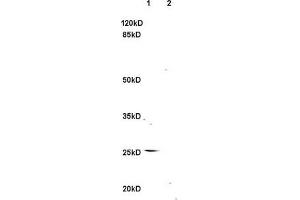 L1 rat brain, L2 rat kidney lysates probed (ABIN740625) at 1:200 in 4 °C. (TNFSF14 antibody  (AA 141-240))