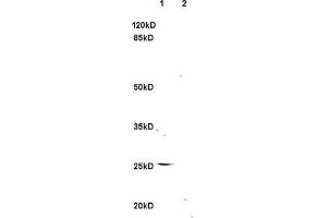 L1 rat brain, L2 rat kidney lysates probed (ABIN740625) at 1:200 in 4 °C. (TNFSF14 antibody  (AA 141-240))