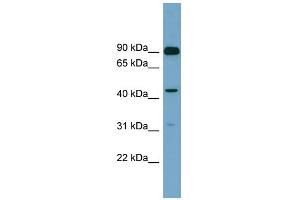 WB Suggested Anti-DGKA Antibody Titration: 0. (DGKA antibody  (N-Term))