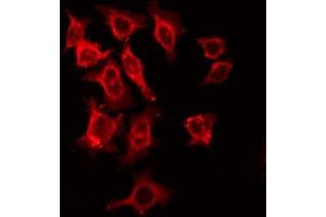 ABIN6266484 staining HeLa by IF/ICC. (IL2 Receptor beta antibody  (Internal Region))