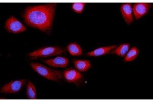 IF analysis of SRP72 using anti-SRP72 antibody (ABIN7601648).