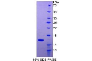 SDS-PAGE (SDS) image for Growth Differentiation Factor 2 (GDF2) (AA 320-429) protein (His tag) (ABIN1079755)