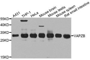 Western blot analysis of extracts of various cell lines, using CAPZB antibody.
