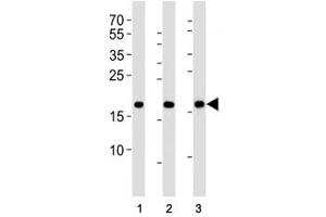 Western blot analysis of lysate from HepG2, NCCIT, mouse NIH3T3 cell line (left to right) using HMGA2 antibody (HMGA2 antibody  (N-Term))