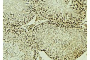 ABIN6269325 at 1/100 staining Mouse testis tissue by IHC-P. (PKC zeta antibody  (C-Term))