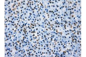 Immunohistochemical staining of paraffin-embedded colon tissue using anti-HDAC10mouse monoclonal antibody. (HDAC10 antibody)