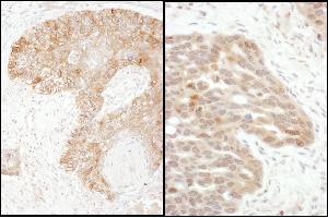 Immunohistochemistry (IHC) image for anti-TS (C-Term) antibody (ABIN7795593) (TS (C-Term) antibody)