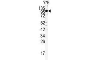 Western blot analysis of KIF3C antibody (C-term) in Y79 cell line lysates (35ug/lane). (KIF3C antibody  (C-Term))