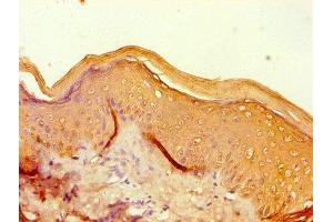 Immunohistochemistry of paraffin-embedded human skin tissue using ABIN7152936 at dilution of 1:100 (Filaggrin antibody  (AA 3838-4061))