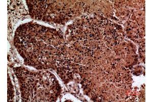 Immunohistochemistry (IHC) analysis of paraffin-embedded Human Lung, antibody was diluted at 1:100. (IFNGR1 antibody  (Internal Region))