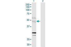Lane 1: ZNF277 transfected lysate ( 51.