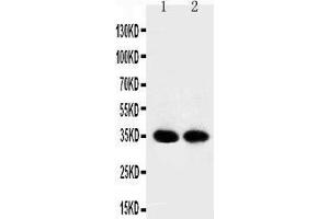 Anti-APE1 antibody, Western blotting Lane 1: Rat Brain Tissue Lysate Lane 2: Mouse Brain Tissue Lysate (APEX1 antibody  (Middle Region))