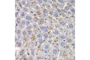 Immunohistochemistry of paraffin-embedded mouse liver using SND1 antibody.
