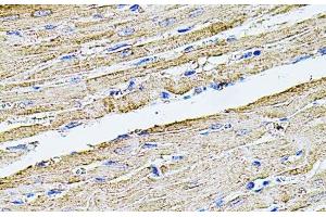 Immunohistochemistry of paraffin-embedded Rat heart using FLNB Polyclonal Antibody at dilution of 1:100 (40x lens). (FLNB antibody)