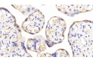 Immunohistochemistry (IHC) image for anti-Transferrin Receptor (p90, CD71) (TFRC) (AA 578-765) antibody (ABIN7437038)