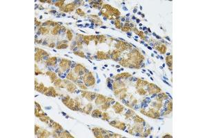 Immunohistochemistry of paraffin-embedded human stomach using HAPLN1 antibody. (HAPLN1 antibody  (AA 165-354))